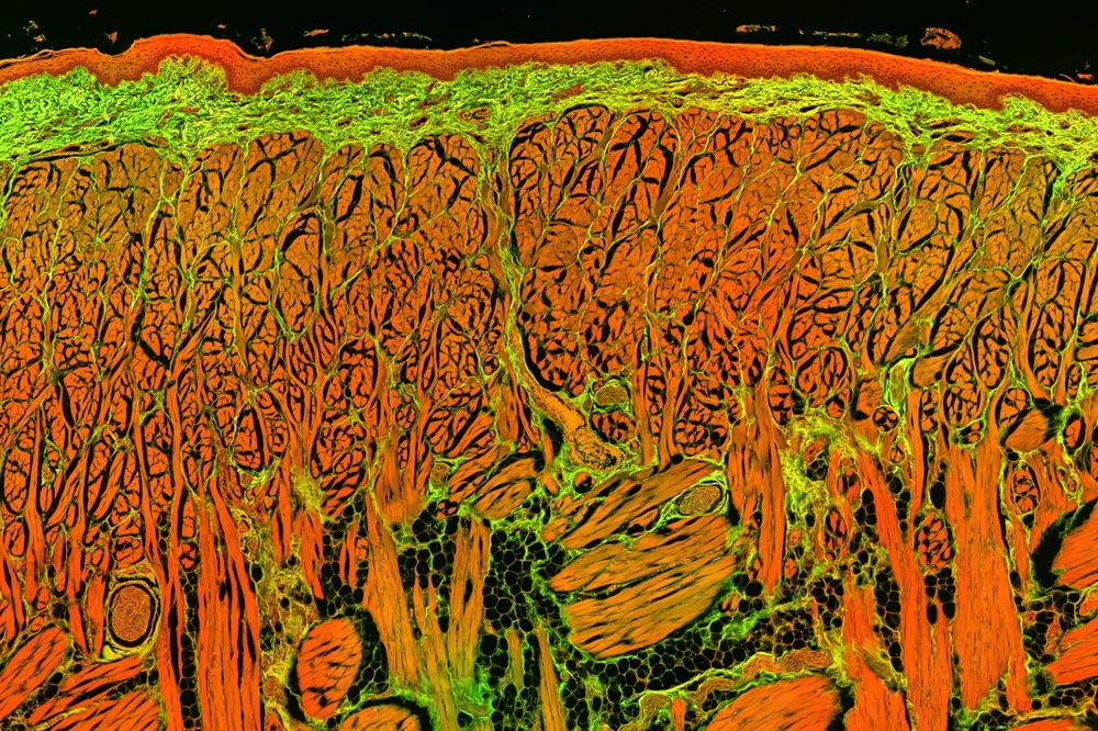 Fluorescence Lifetime Imaging Microscopy